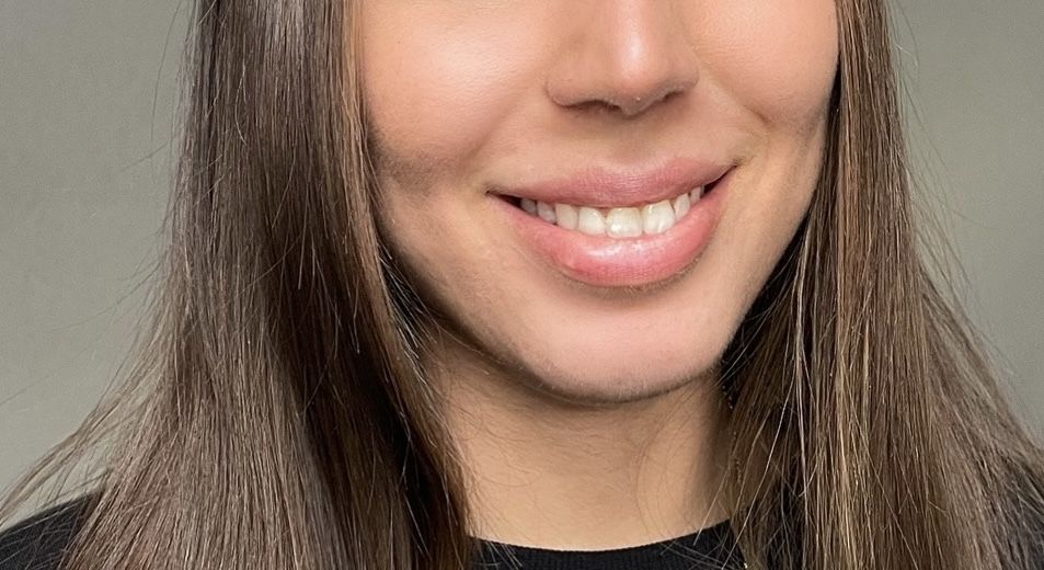Customer photo review of Salicylsäure BHA 2% 50 ml