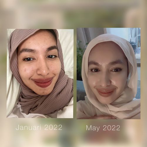 Customer photo review of Teamon Beetroot Mask