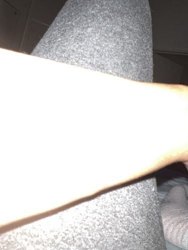 Customer photo review of LightenUp Anti-Aging Sunscreen SPF 50