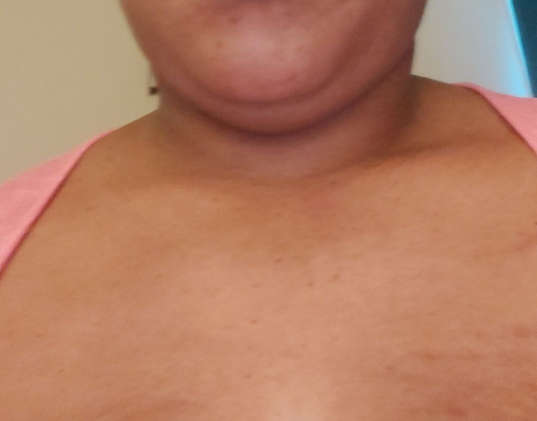 Customer photo review of Fair and White So White Skin Perfector Purifying Cream 250ml / 8.4 fl oz