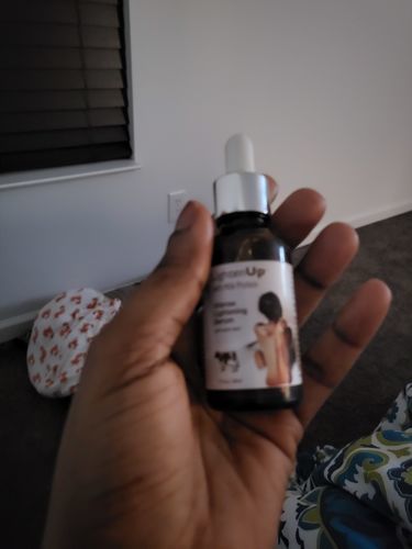 Customer photo review of Omic Lightenup Lactic Acid Active Intense Brightening Serum - 30ml