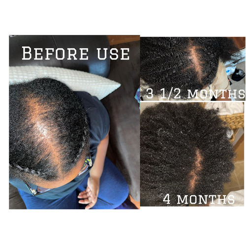 Customer photo review of Kai - Washday Duo