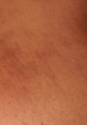 Customer photo review of LightenUp Anti-Aging Sunscreen SPF 50