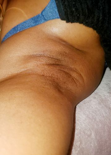 Customer photo review of Double Honey Kit