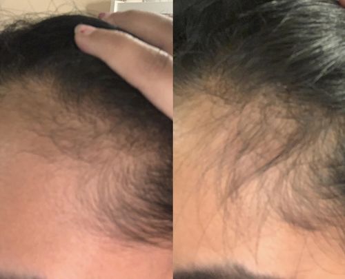 Customer photo review of Inches - Hair & Beard Oil