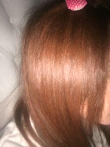 Customer photo review of PACK SHAMPOO ANTICAIDA  + ACONDICIONADOR 300 ML