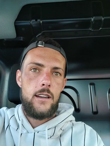 Customer photo review of Teeth-Veneer 2.0