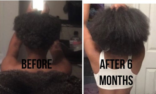 Customer photo review of India’s Secret Ancient Ayurvedic Hair Follicle Elixir (3 sizes)