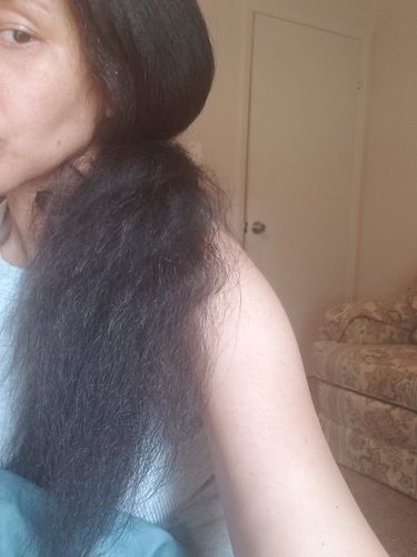 Customer photo review of Maximum Strength Hair Growth Bundle