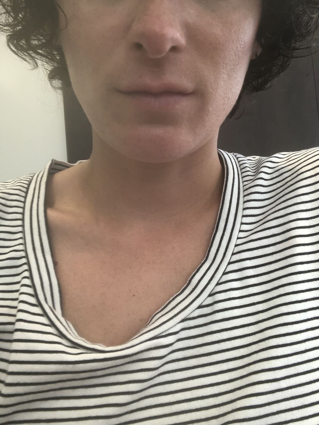 Customer photo review of Good Skin - 3 mois