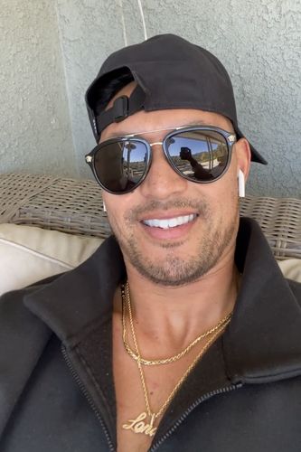 Customer photo review of bedrō Whitening