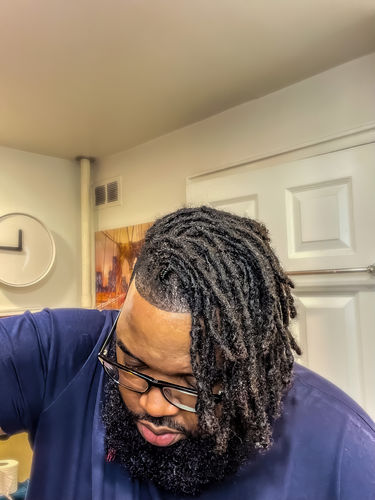 Customer photo review of Locs Anti-Itch Detox Kit