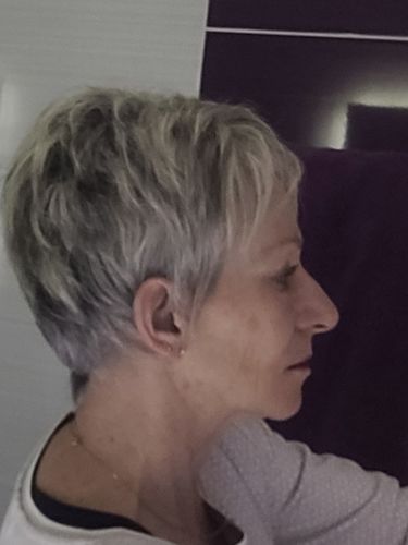 Customer photo review of Sarahbio - huile de pépins de figue de barbarie - 30 mL