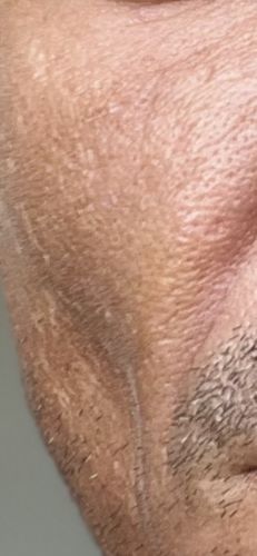 Customer photo review of Niacid