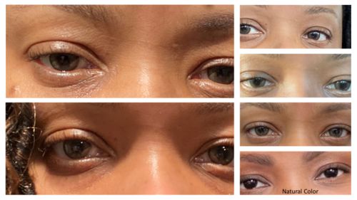 Customer photo review of Neil Hazel Contact Lenses(12 months wear)