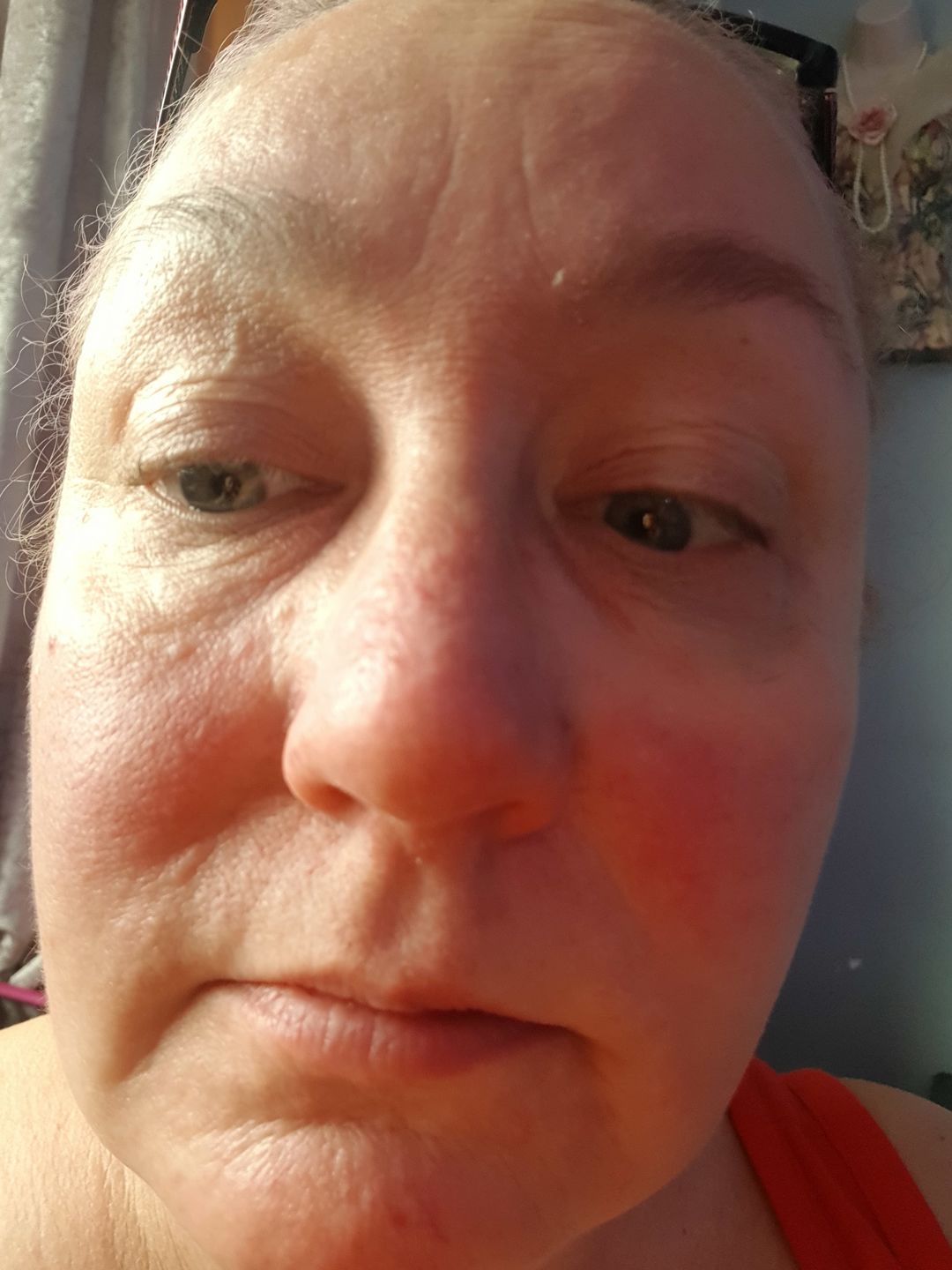 Customer photo review of Healing Miracle Cream