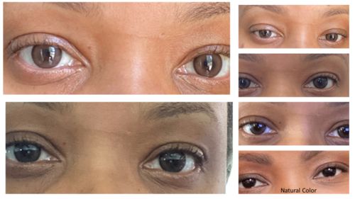 Customer photo review of Neil Choco Contact Lenses(12 months wear)