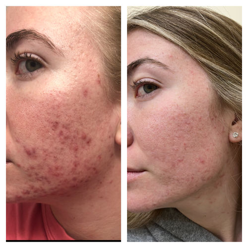 Ashley C. review of Qasil Powder for Hair and Skin, Organic Qasil Powder, Qasil Powder for Face, Pack of 1, 150gm image 1 out of 1