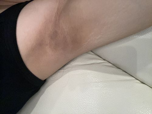 Customer photo review of Hard Wax - 2.2LB - Smooth Nectar