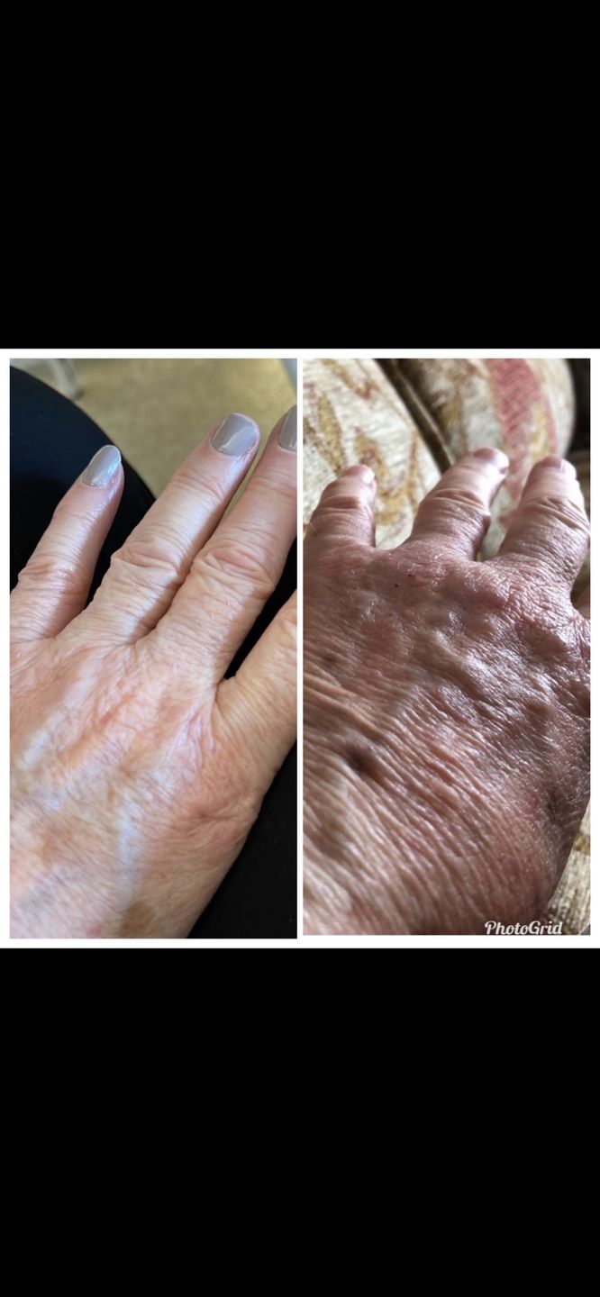Customer photo review of Intensive Night Balm