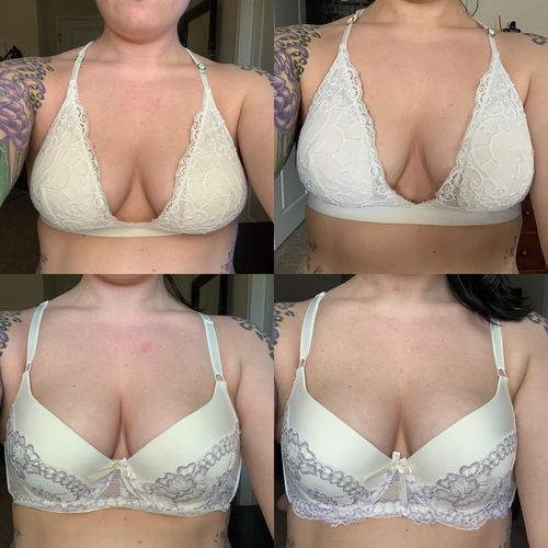Customer photo review of Mandalashley™ Breast Plumping Oil