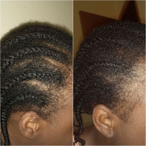 Customer photo review of Hair Growth Potion - Extra Strength