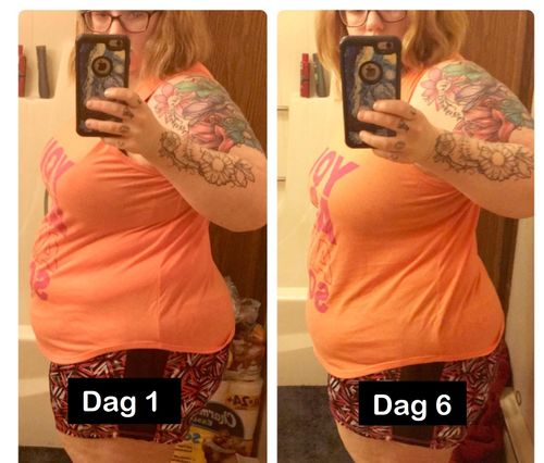 Customer photo review of Mandalashley™ Mage Bort med Organiskt Fotplåster