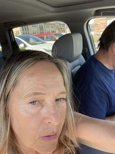 Customer photo review of EvenSkyn® Phoenix: Premium Face Lifting Microcurrent Bar