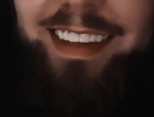 Customer photo review of Teeth-Veneer 2.0