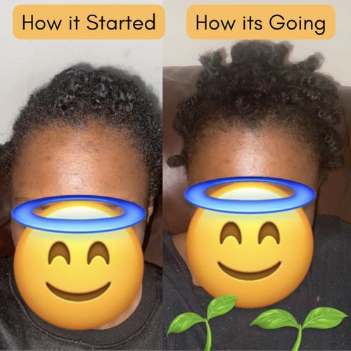 Customer photo review of Hair Growth Potion - Extra Strength