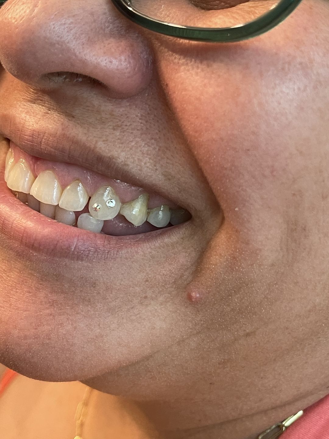 Customer photo review of Crystal Clear 2.3mm 5-pack