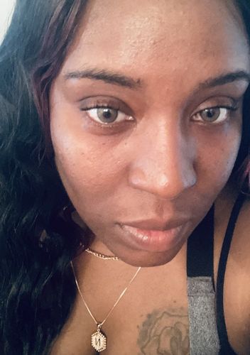 Customer photo review of Neala Brown Contact Lenses(12 months wear)