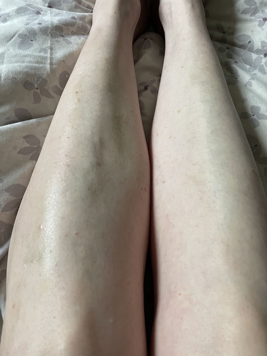 Customer photo review of Repair, Healing & Relaxing Set