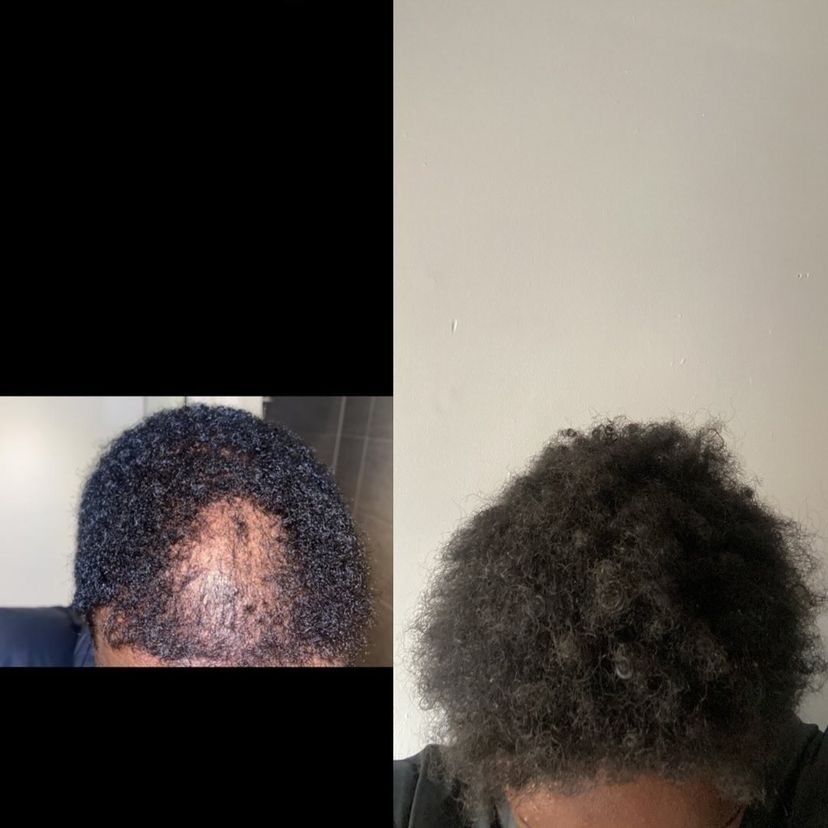 Customer photo review of Multi-Vitamin Deep Hydration Masque