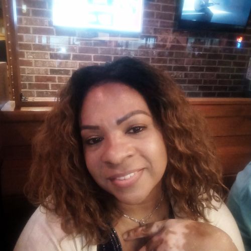 Customer photo review of Fair and White Original Whitening Gel Cream 30 gm / 1 fl oz