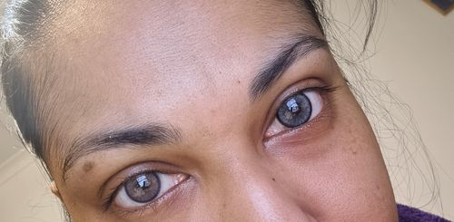 Customer photo review of Asa Gray Contact Lenses(12 months wear)
