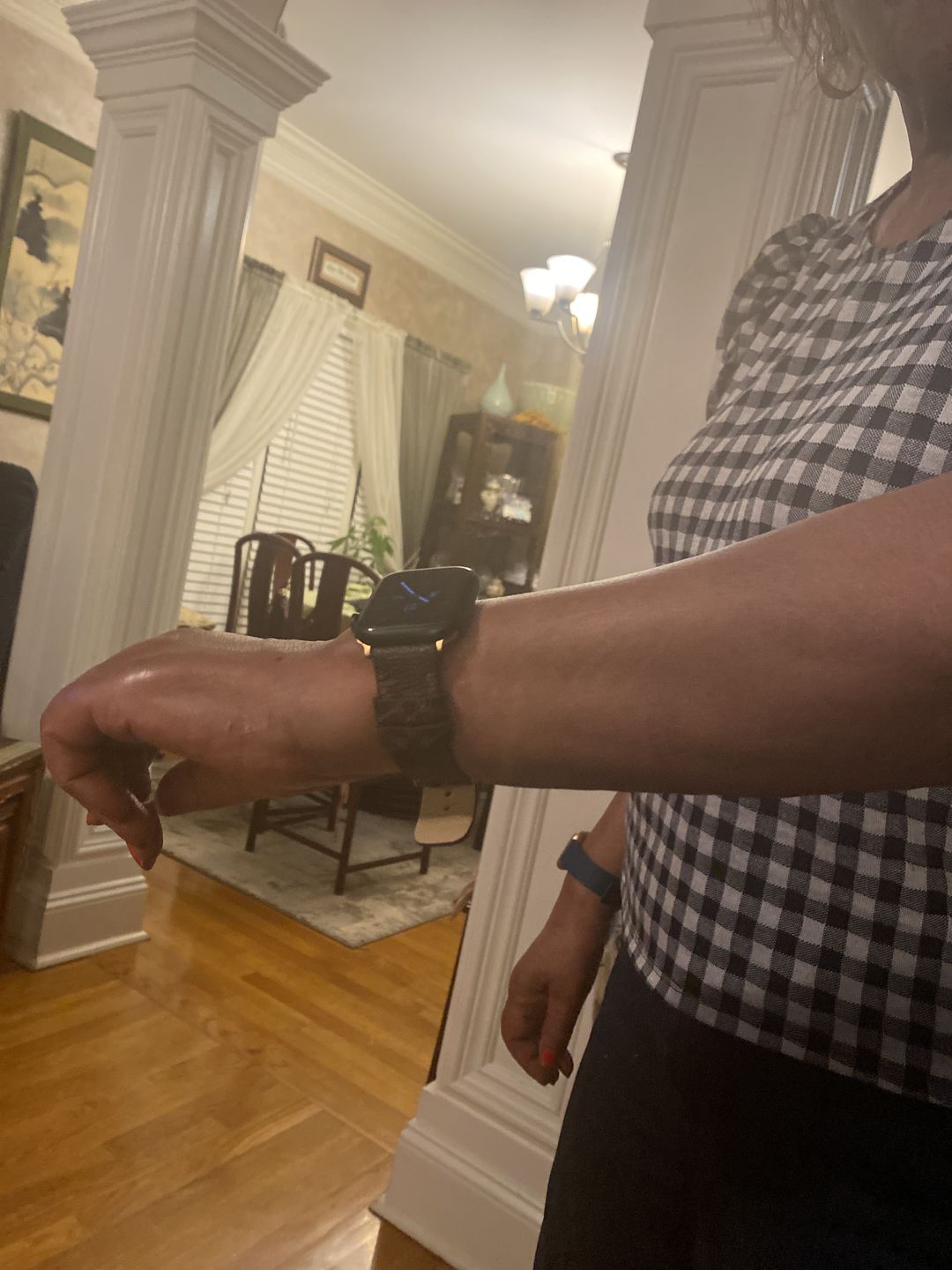 Customer photo review of Apple Watch Band Classic LV Monogram