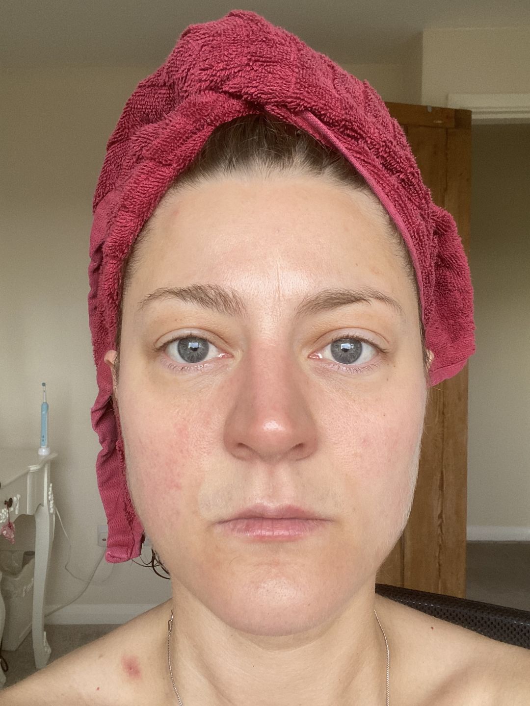 Customer photo review of Healing Miracle Cream