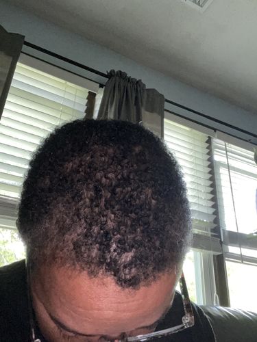 Iris R. review of Fro Butter with Emu Oil - Hair Growth Treatment | For Damaged & Brittle Hair image 1 out of 1