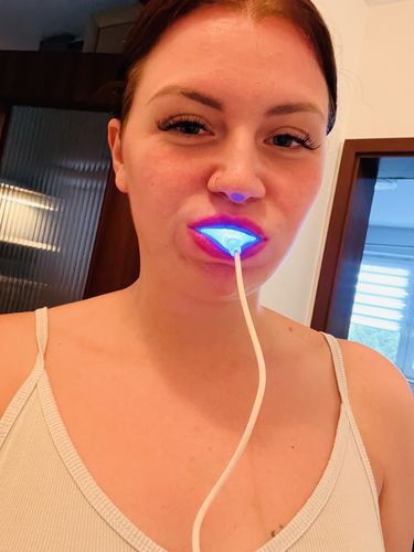 Customer photo review of PAP+ Complete Set