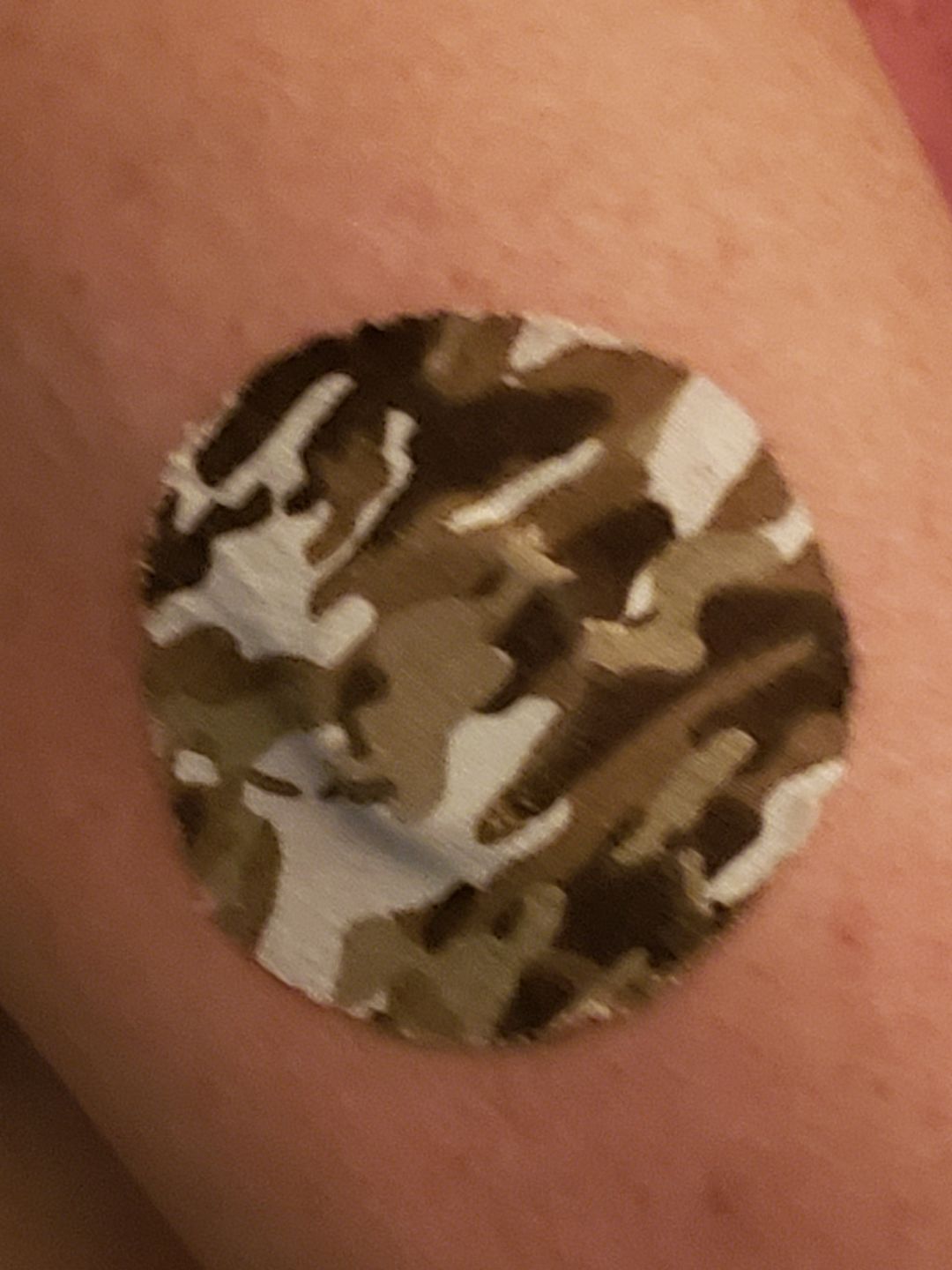 Customer photo review of Skin Grip Omnipod Adhesive Patches