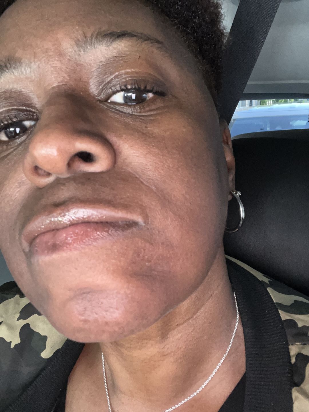 Customer photo review of A-Dream Brightening Eye Cream
