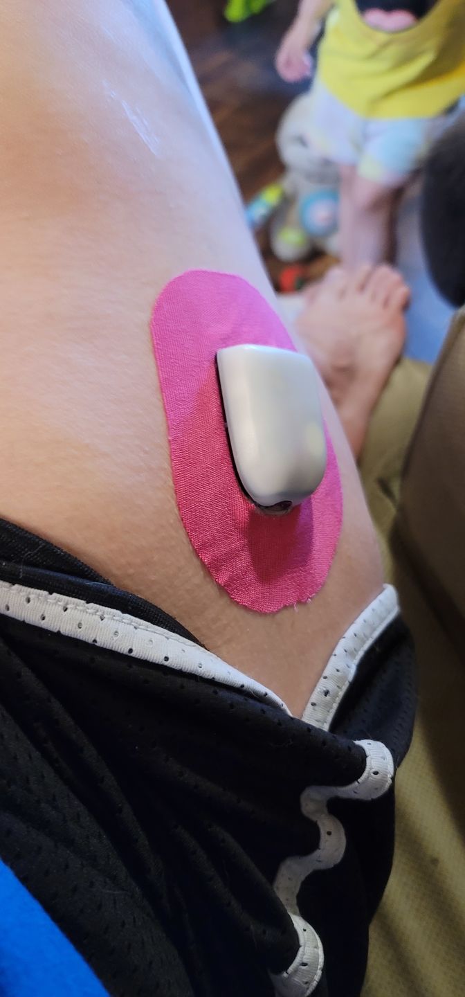 Customer photo review of Skin Grip Omnipod Adhesive Patches