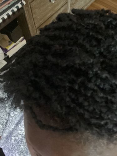Customer photo review of Hair Recovery Bundle
