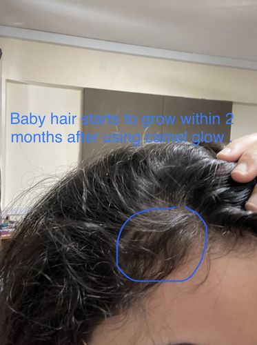 Customer photo review of Growth & Shine Hair Oil
