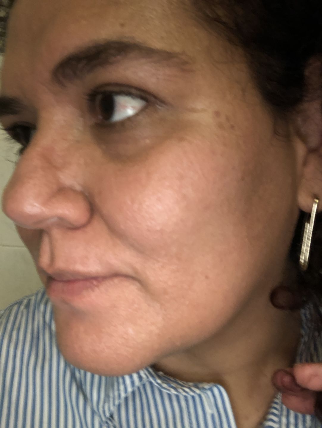 Customer photo review of Opuntia Facial Serum / Suero Facial Opuntia