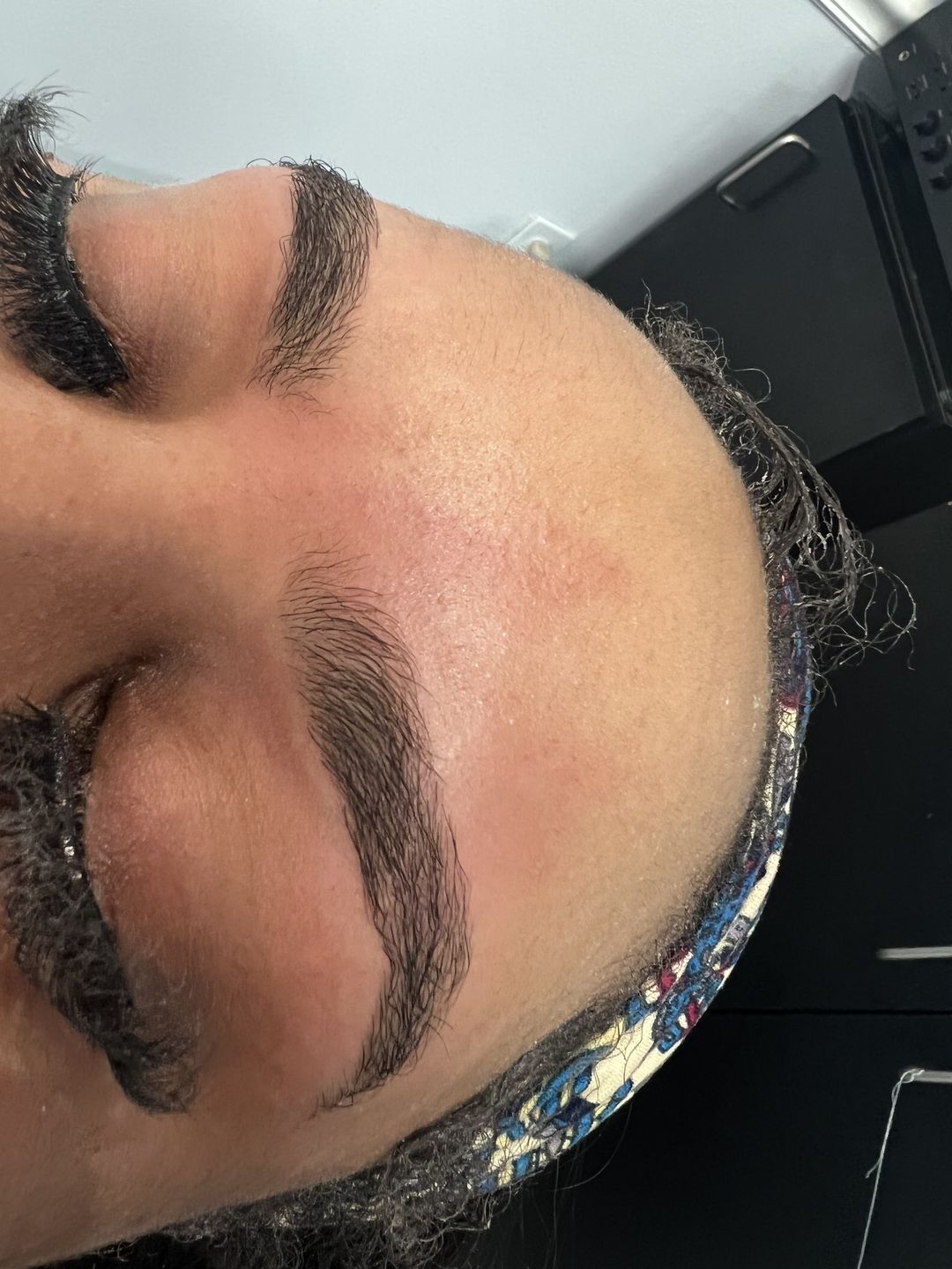 Customer photo review of At-Home Signature Series Hair Removal Wax