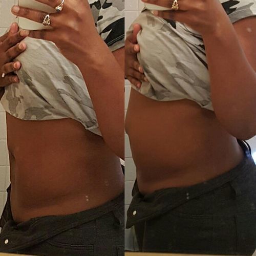 Customer photo review of Hot Sale - Herbal Slimming Patch（50% OFF 🔥 TODAY ONLY）