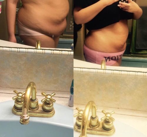 Customer photo review of Hot Sale - Herbal Slimming Patch（50% OFF 🔥 TODAY ONLY）