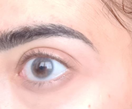 Customer photo review of Asa Blue Contact Lenses(12 months wear)